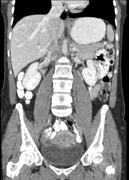 Computed Tomography (CT)